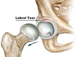 The Hip Labrum